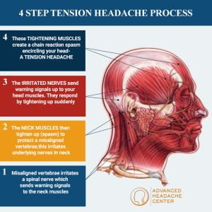 Understanding And Managing Your Tension Headache Advanced Headache Center Understanding And Managing Your Tension Headache Advanced Headache Center