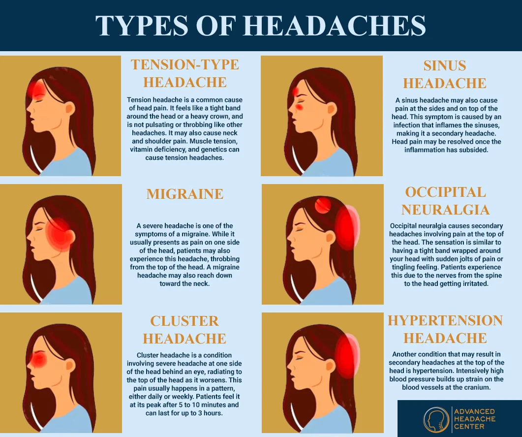 Common Types of Headaches to Worry About Advanced Headache Center